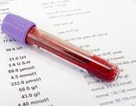 تحليل الدم الشامل ماذا يكشف؟ وخطوات ما قبل القيام بتحليل الدم الشامل