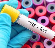 ما هو crp test وما الخطوات التي يتم اتخاذها لتقليل ارتفاع CRP