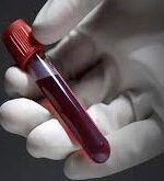 ماهي فصيلة الدم النادرة … أهمية معرفة فصائل الدم