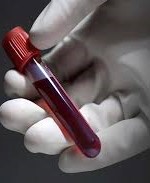 ماهي فصيلة الدم النادرة … أهمية معرفة فصائل الدم