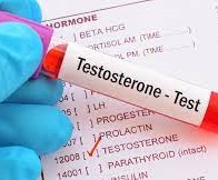 نسبة هرمون التستوستيرون الطبيعية عند الرجال وطرق علاج نقصه